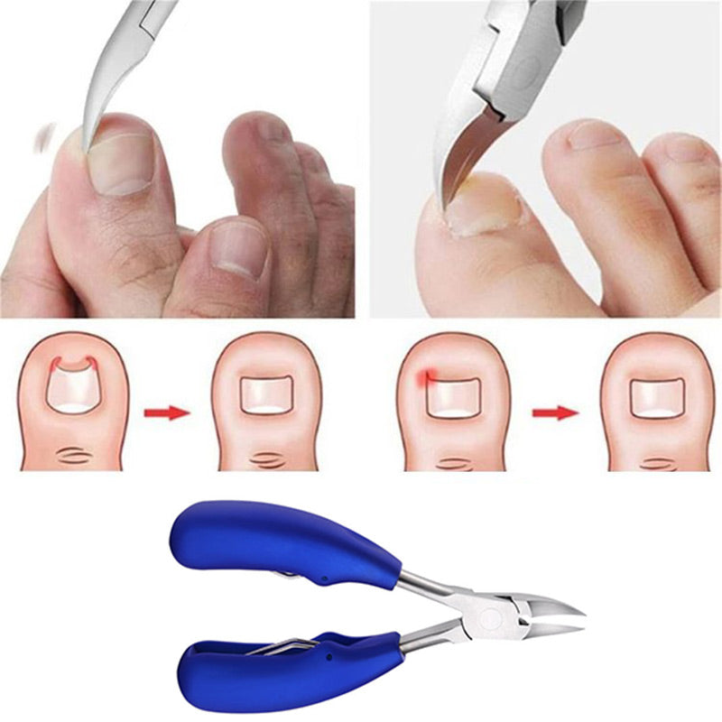 Precise & Ultra Sharp Nail Trimmer